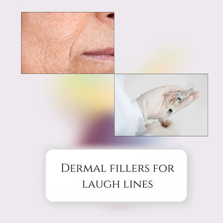 Dermal Fillers for Laugh Lines: Treatment Insights and Options - Filler Lux™