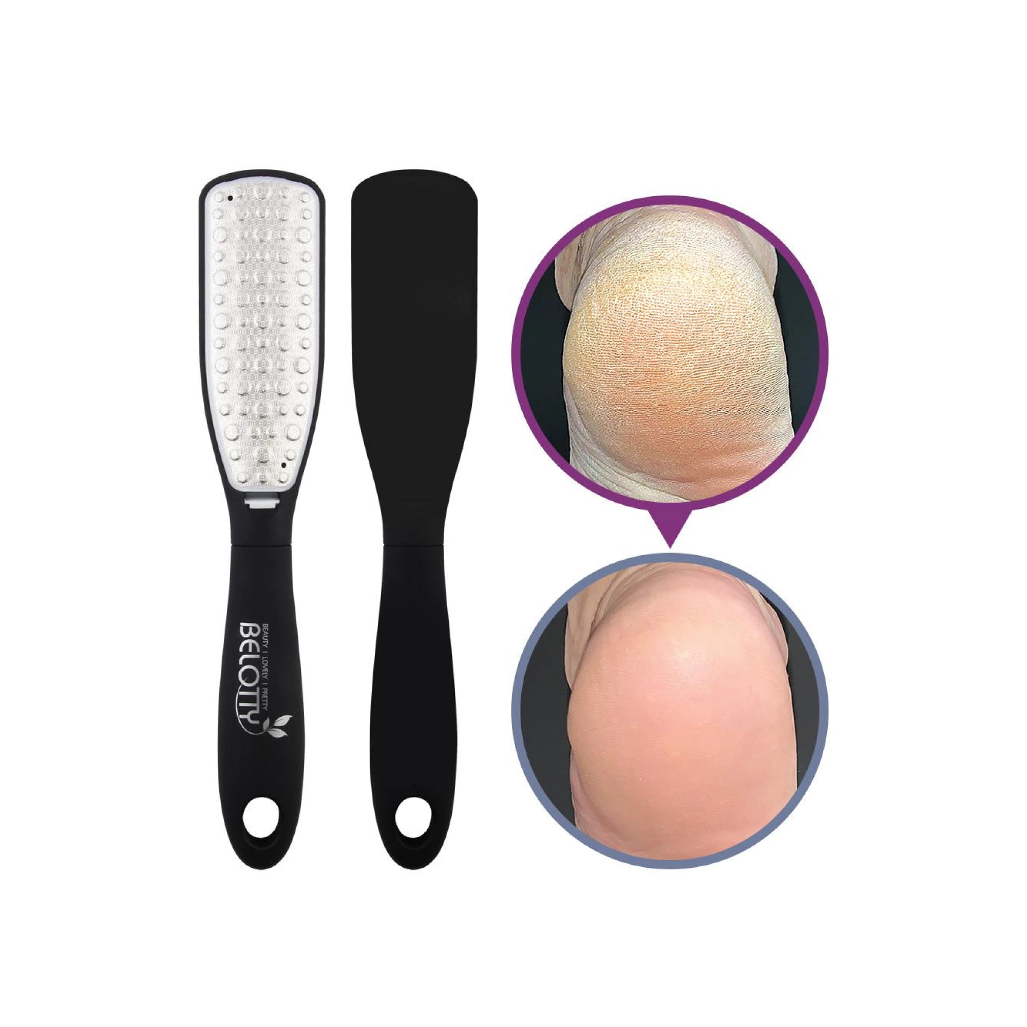 Laser Metal Foot File – Single-Sided