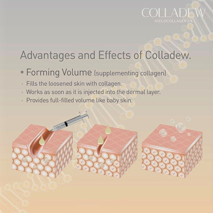 Colladew Atelocolagen 3% - Filler Lux™ - Mesotherapy - Quiver Medic