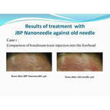 JBP Nanoneedle Premier - Filler Lux™ - Needles - Japan Bio Products Co., Ltd.